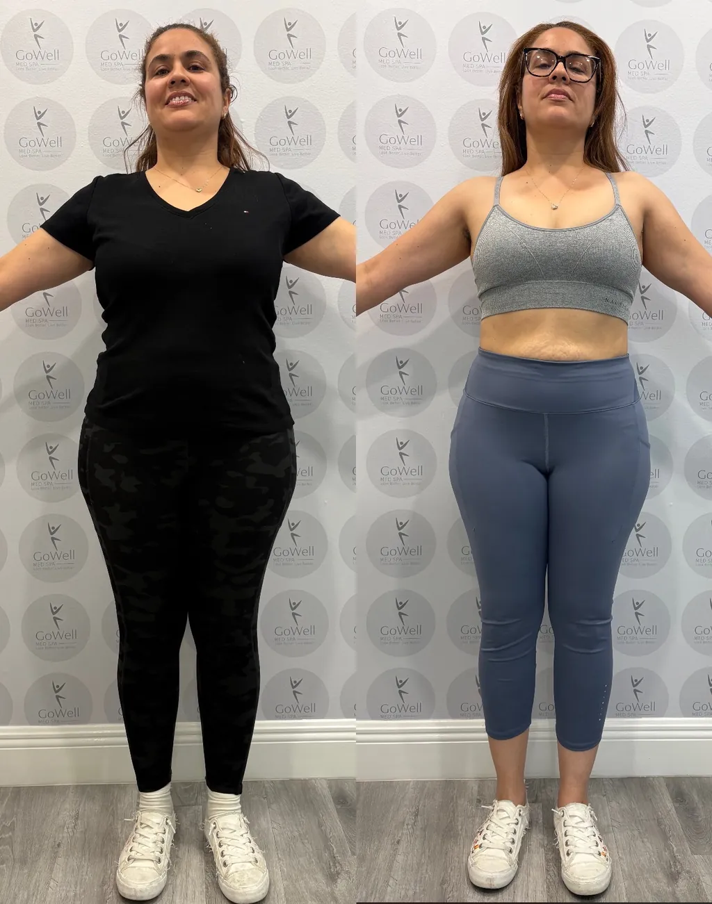 Before and after photos of a GoWell client's medical weight loss
