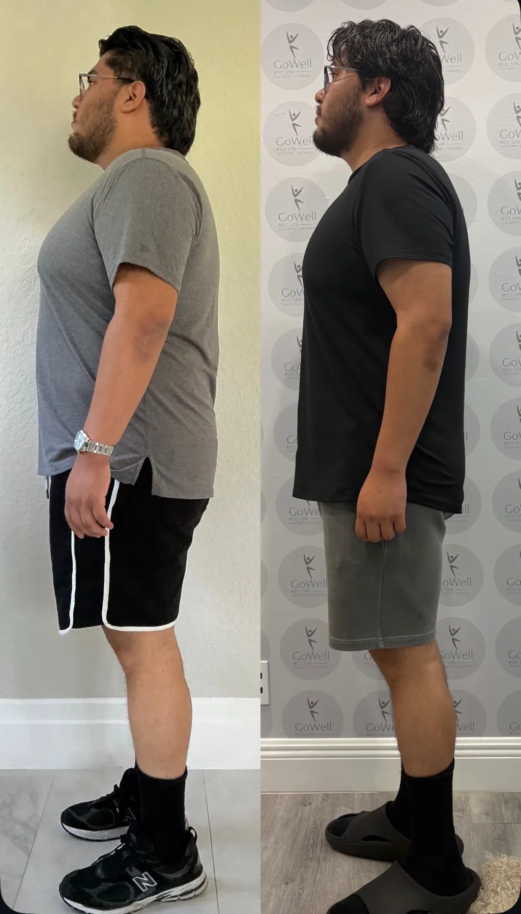 Before and after side profile of a male GoWell client's weight loss